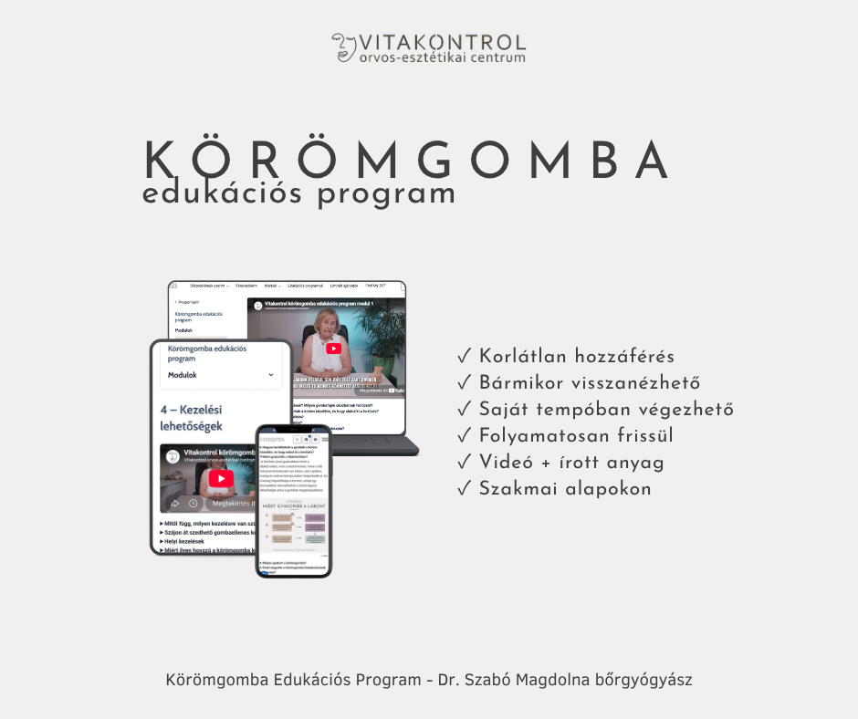 Körömgomba edukációs anyag